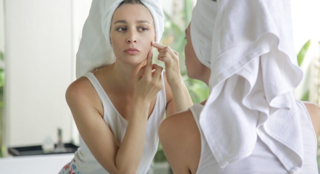 szépségápolás, pattanás, rosacea