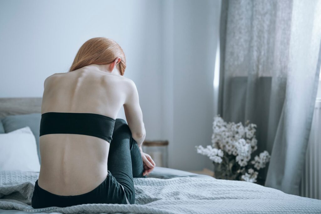 anorexiás nő háttal fordul
