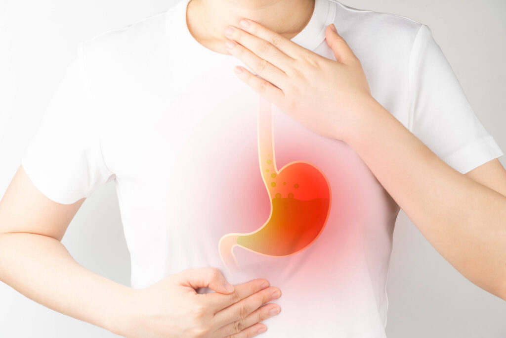 Reflux, gyomor és nyelőcső fájdalom